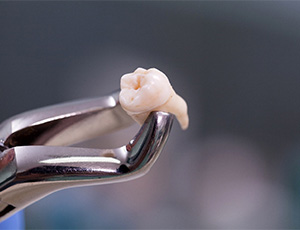 Dental equipment holding an extracted tooth